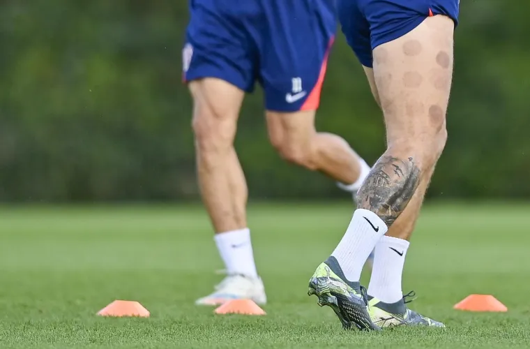 Peri&scaron;ić pokazao čudne fleke na nogama, a jedan detalj mogao bi nas zabrinuti: Drži li se to Vatreni za zadnju ložu?