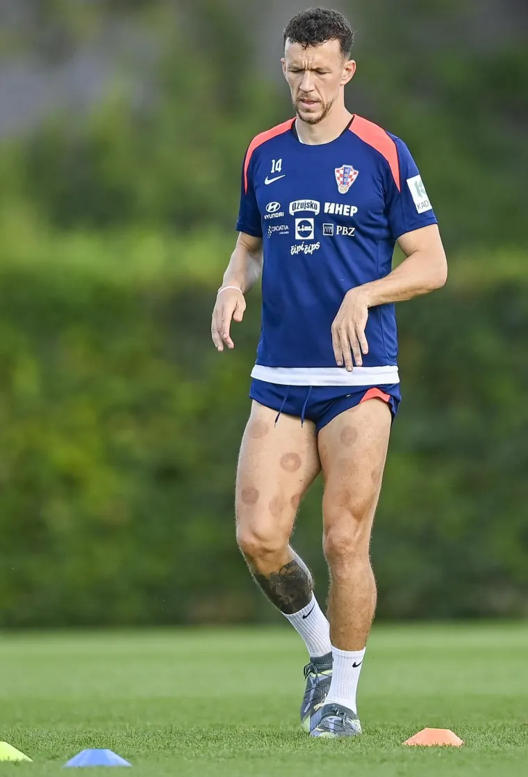 Peri&scaron;ić pokazao čudne fleke na nogama, a jedan detalj mogao bi nas zabrinuti: Drži li se to Vatreni za zadnju ložu?