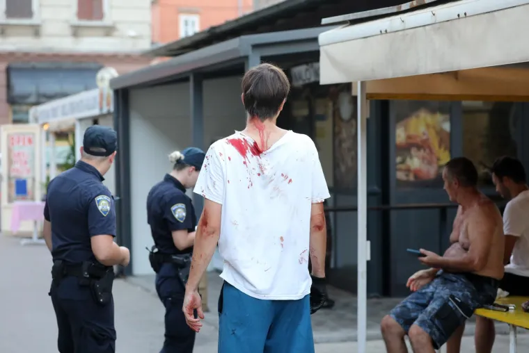 Masovna tučnjava u Istri, ima krvi - potezali se i pištolji za čavle?!