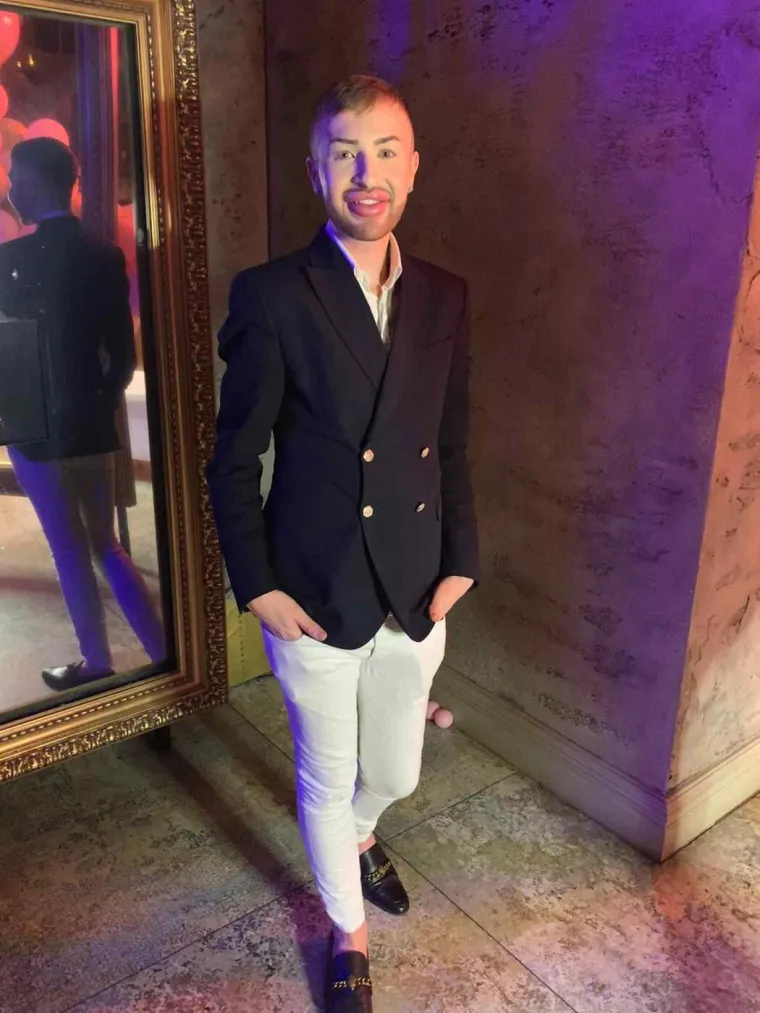 Ovisnost o fileru i botoksu pretvorila ga u patku, a onda je napravio čudo: Sada izgleda kao maneken