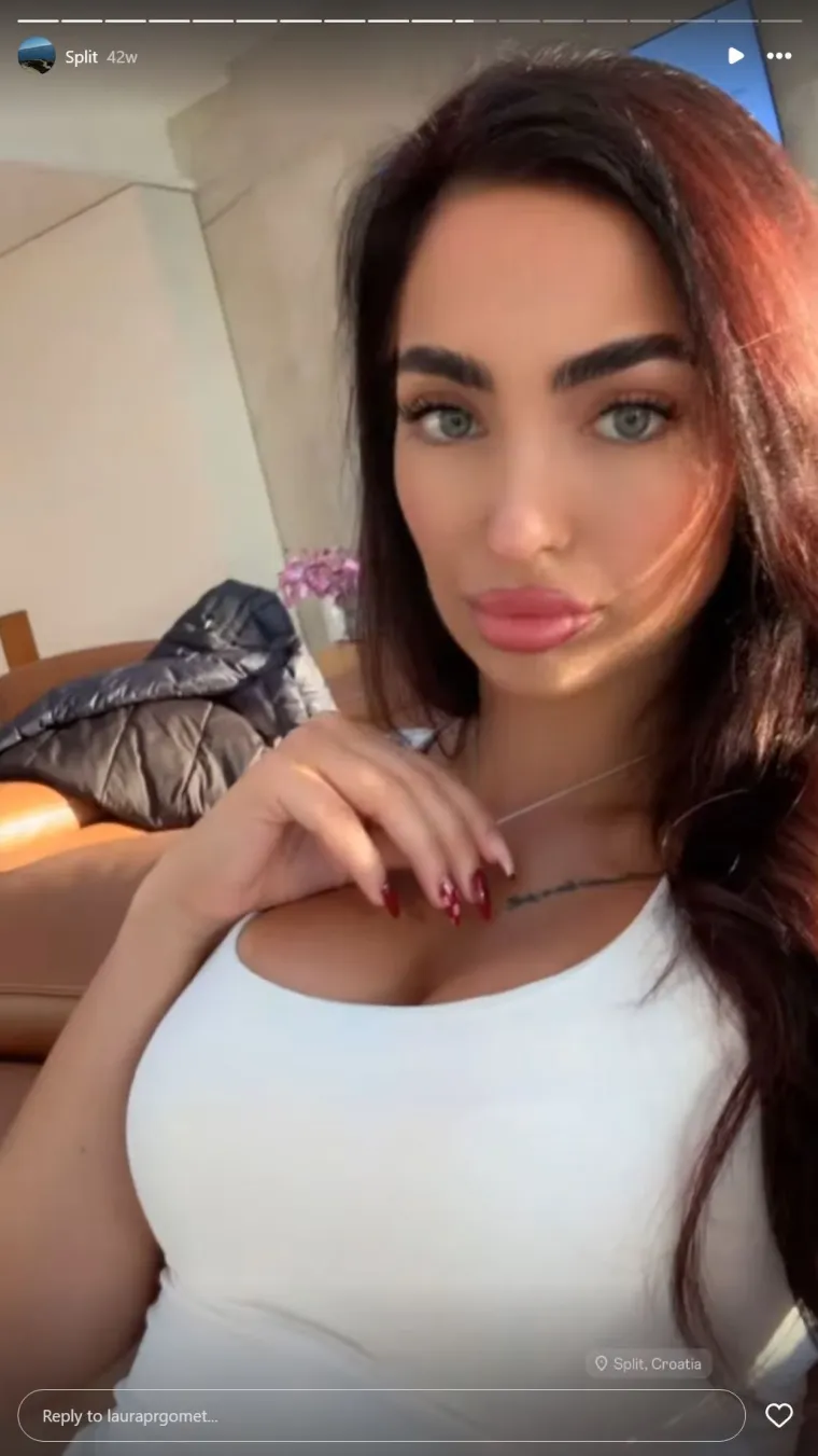 Bila na operaciji grudi i nosa pa opet stavila filere u usne: Laura obožava estetske korekcije