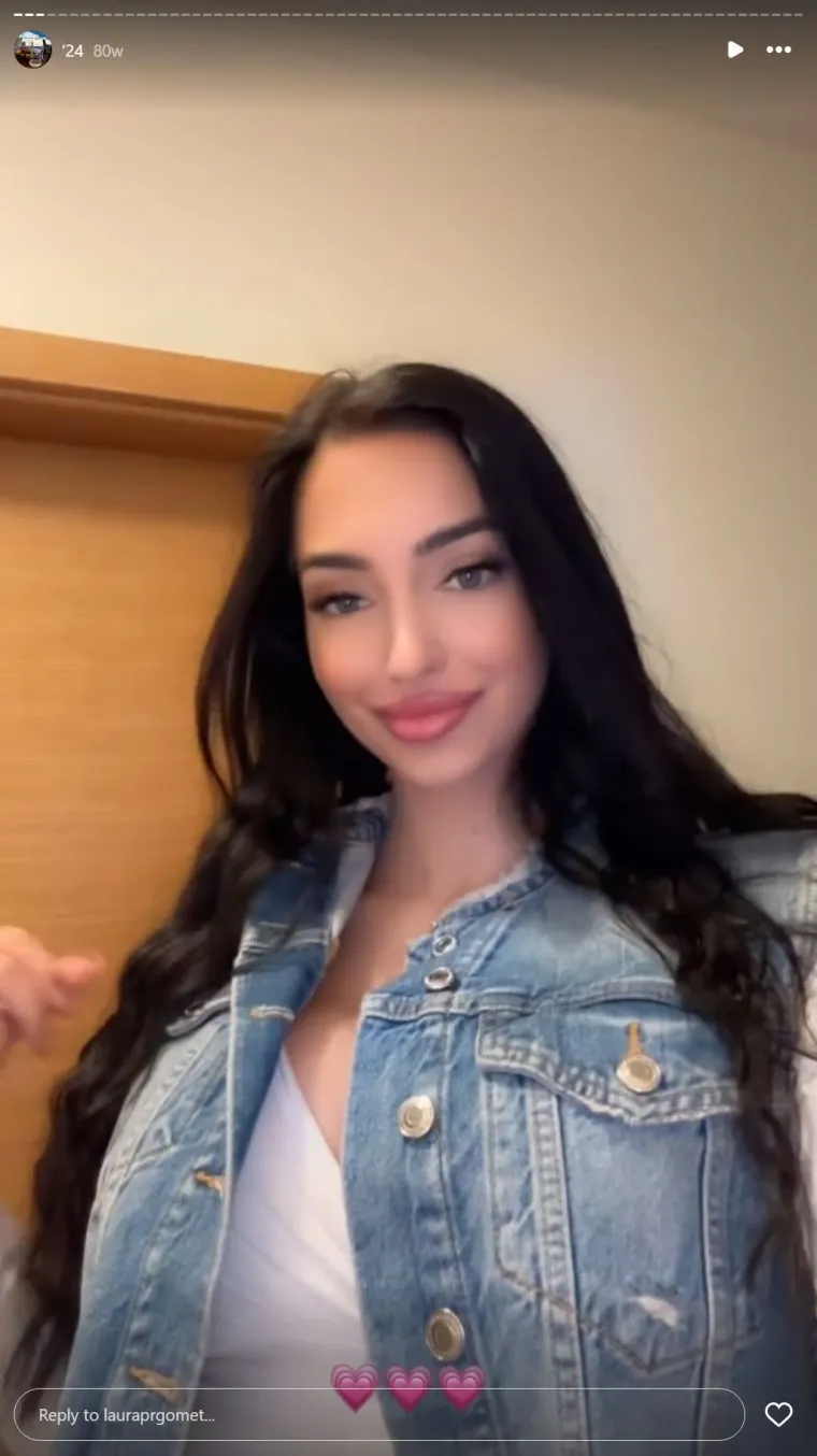 Bila na operaciji grudi i nosa pa opet stavila filere u usne: Laura obožava estetske korekcije