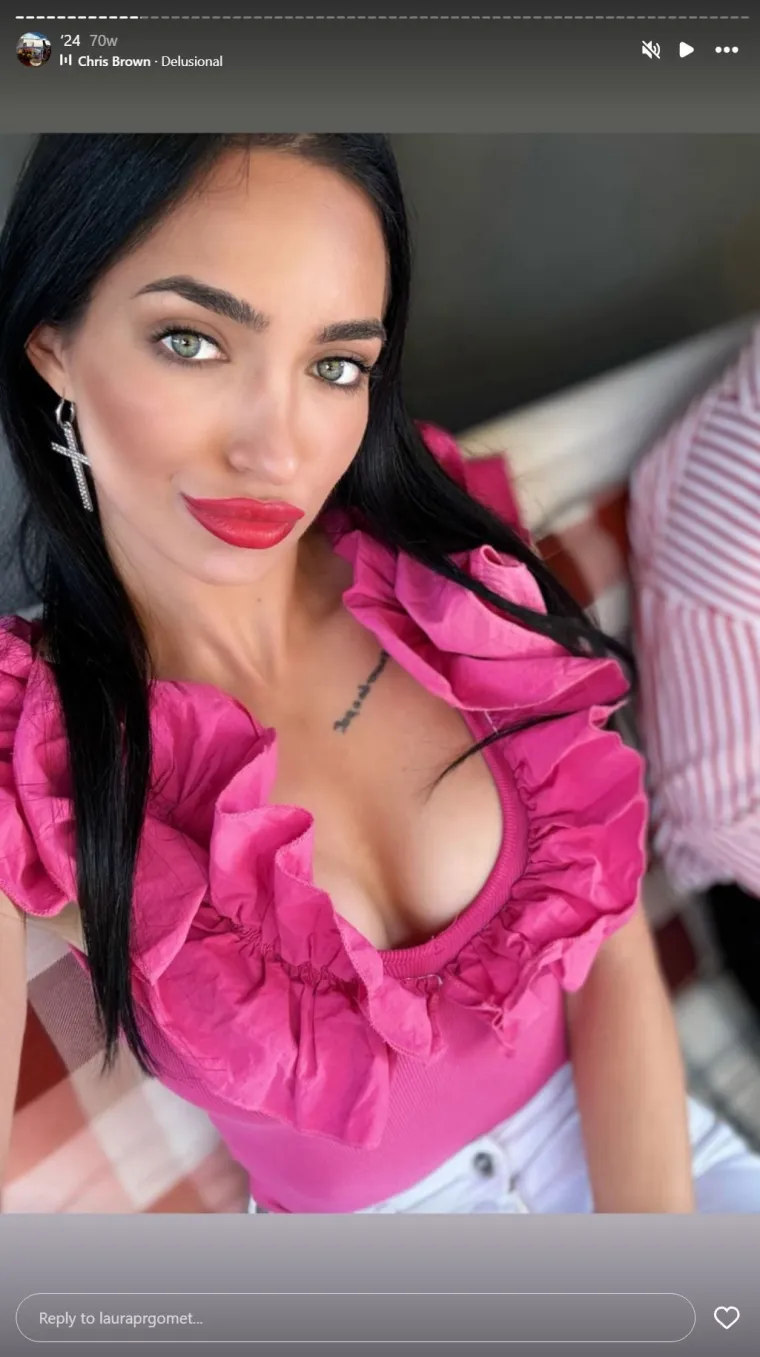 Bila na operaciji grudi i nosa pa opet stavila filere u usne: Laura obožava estetske korekcije