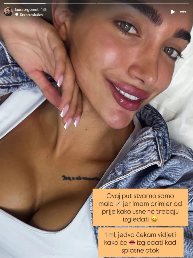 Bila na operaciji grudi i nosa pa opet stavila filere u usne: Laura obožava estetske korekcije