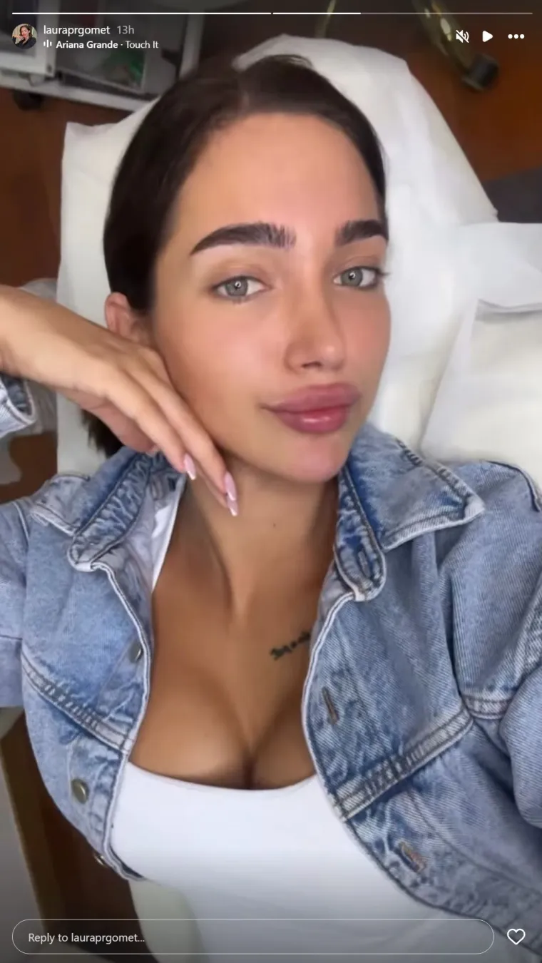 Bila na operaciji grudi i nosa pa opet stavila filere u usne: Laura obožava estetske korekcije