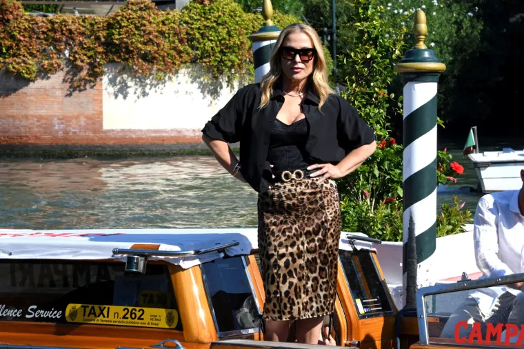 Američka pjevačica dvaput pobijedila rak dojke, često lagala o svojim godinama i bila luda za botoxom