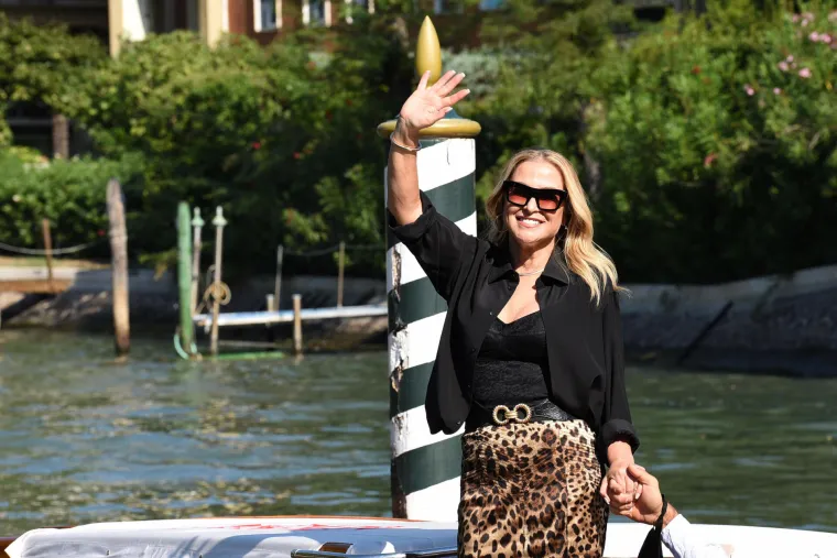 Američka pjevačica dvaput pobijedila rak dojke, često lagala o svojim godinama i bila luda za botoxom