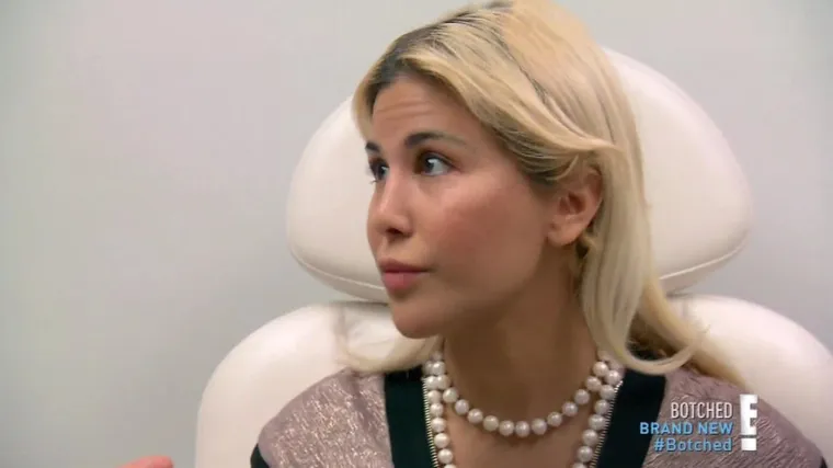 Ona je Ivanka Trump s Temua: Potrošila masne pare na operacije sve dok kirurg nije rekao dosta