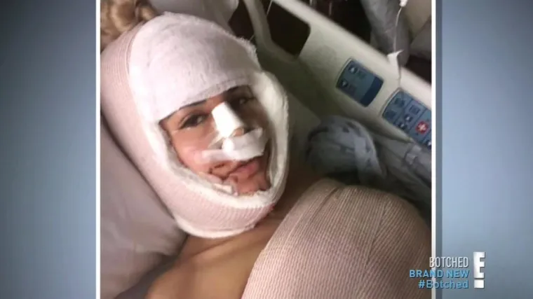 Ona je Ivanka Trump s Temua: Potrošila masne pare na operacije sve dok kirurg nije rekao dosta