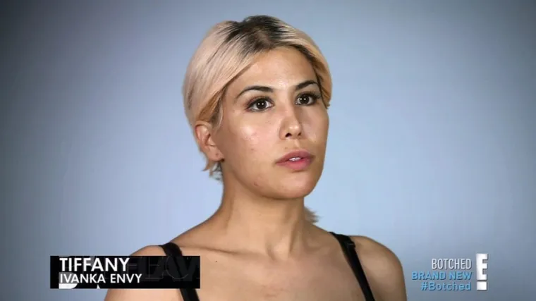 Ona je Ivanka Trump s Temua: Potrošila masne pare na operacije sve dok kirurg nije rekao dosta