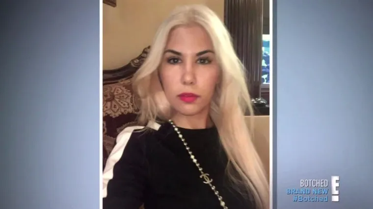 Ona je Ivanka Trump s Temua: Potrošila masne pare na operacije sve dok kirurg nije rekao dosta