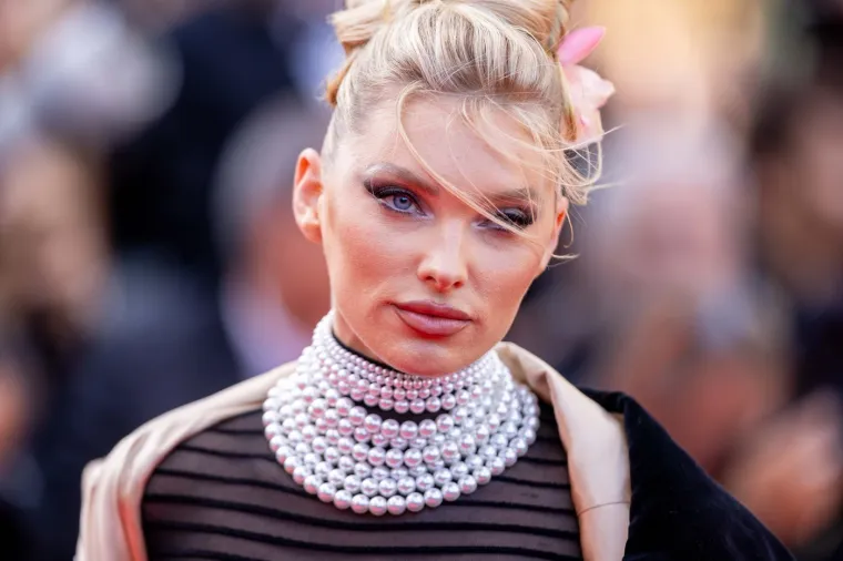 Ona je jedna od najljep&scaron;ih žena svijeta: Prolazila kroz pakao droge, a onda je postala majka