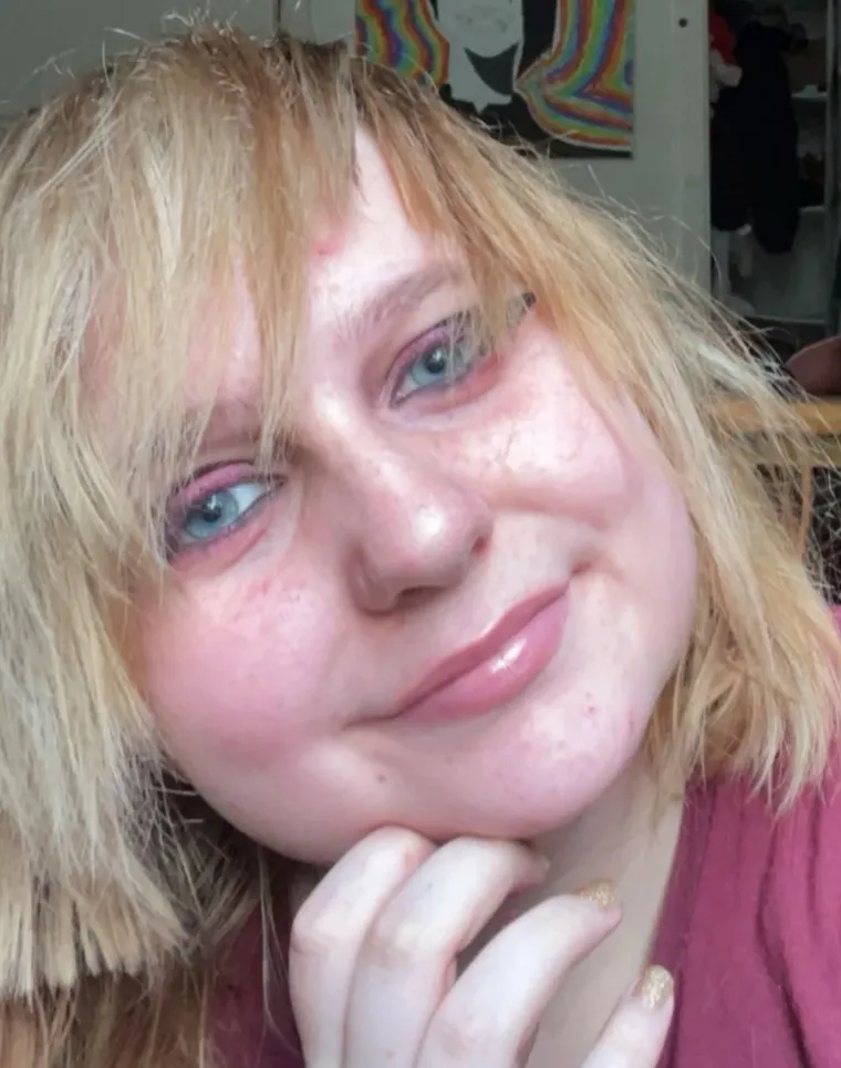 Nekoć su bili ružni pačići, no s vremenom su se toliko proljepšali da su danas neprepoznatljivi