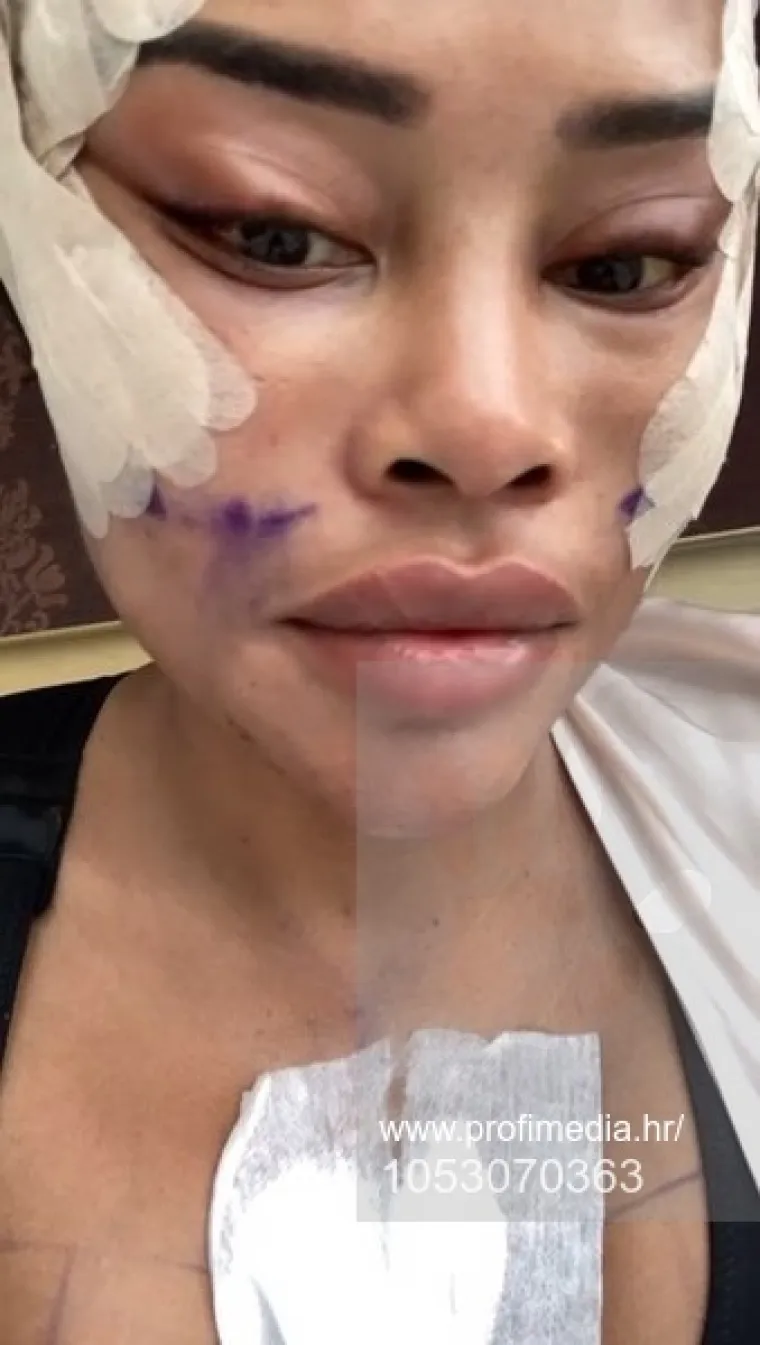 Od njezine transformacije padaju vilice: Potrošila masnu lovu, ovako izgleda danas