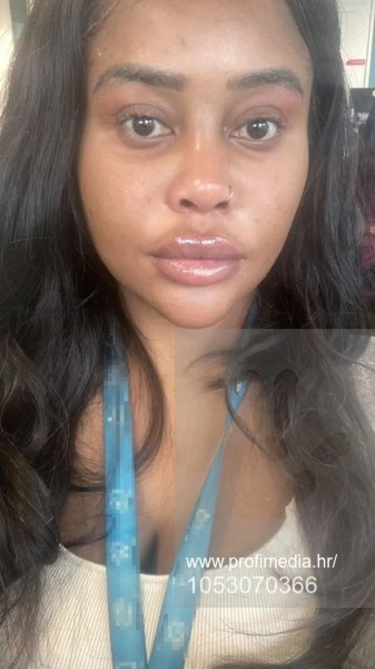 Od njezine transformacije padaju vilice: Potrošila masnu lovu, ovako izgleda danas