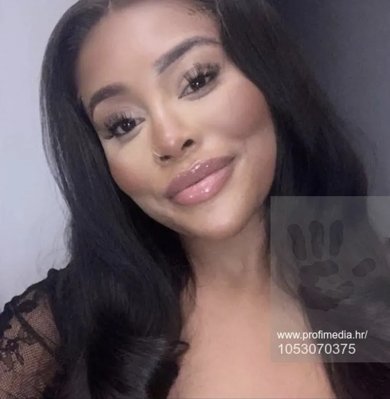 Od njezine transformacije padaju vilice: Potrošila masnu lovu, ovako izgleda danas