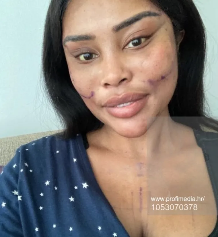 Od njezine transformacije padaju vilice: Potrošila masnu lovu, ovako izgleda danas