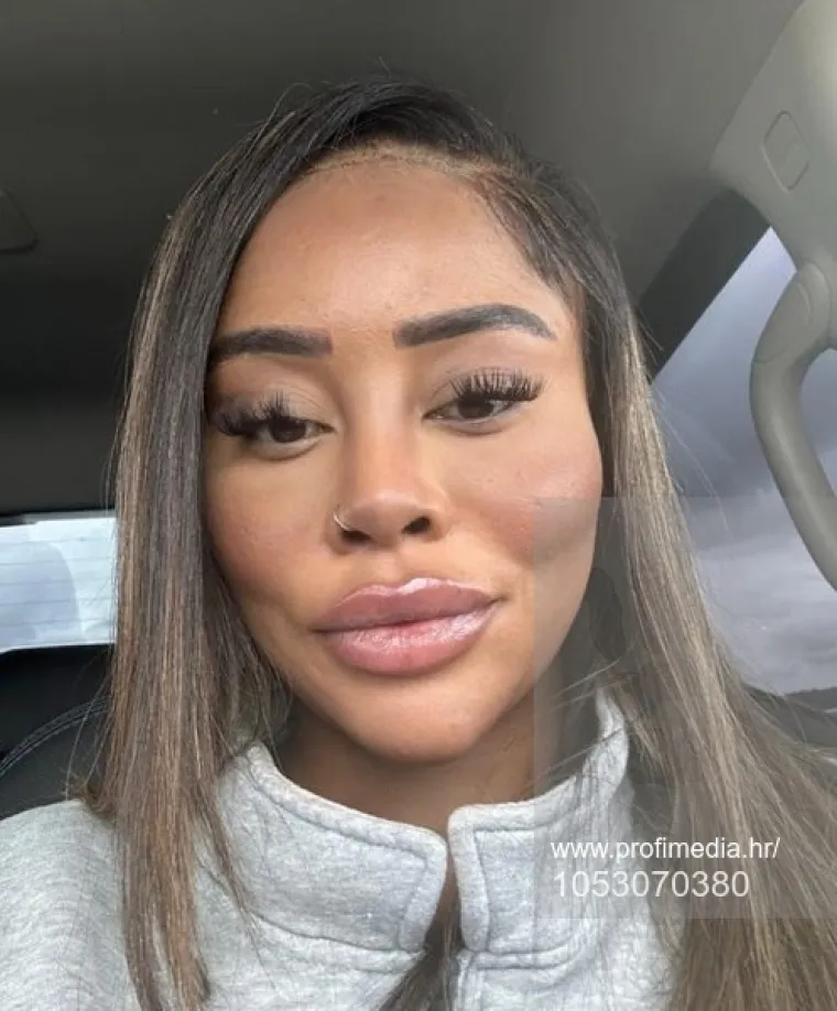 Od njezine transformacije padaju vilice: Potrošila masnu lovu, ovako izgleda danas