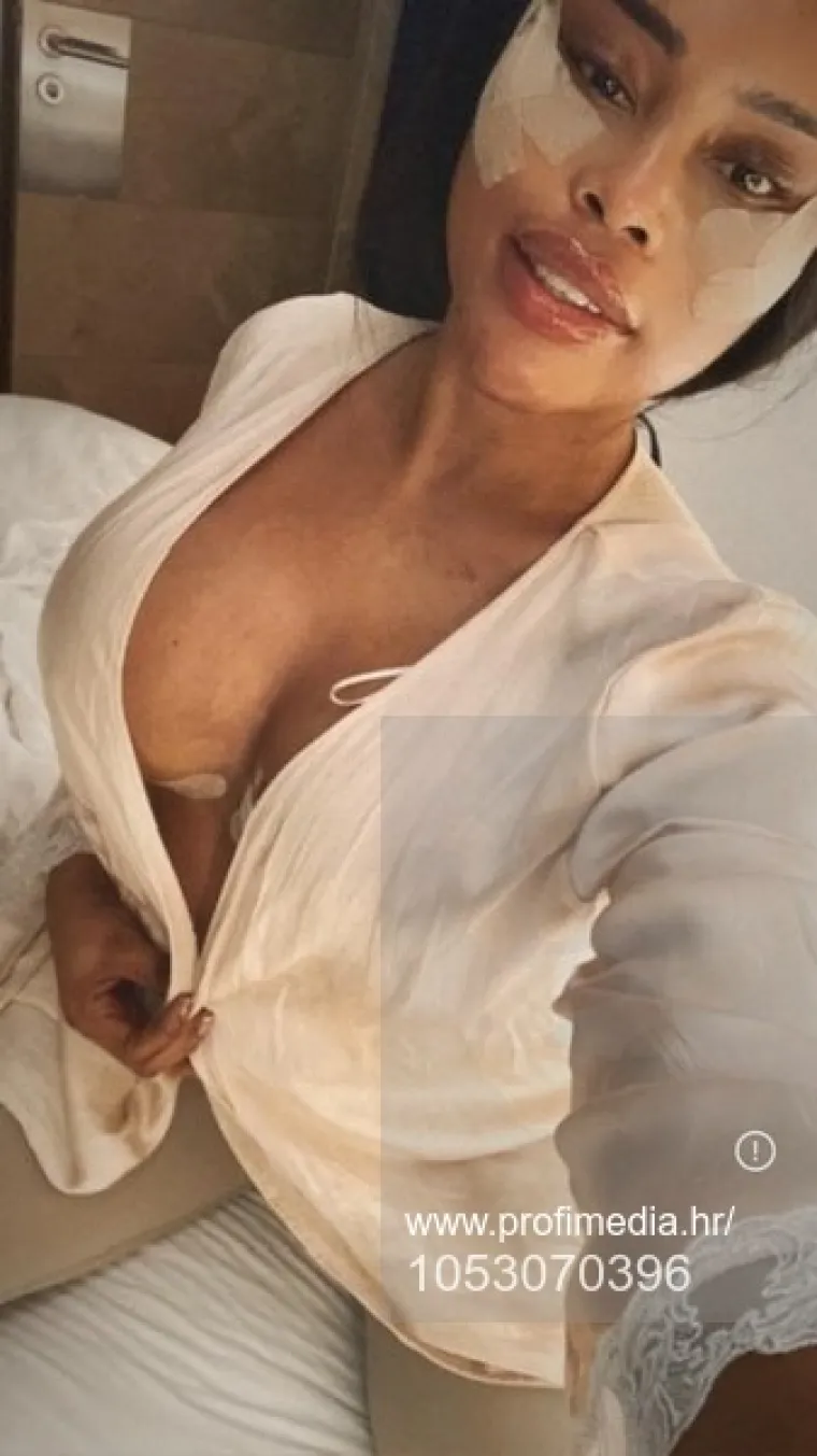 Od njezine transformacije padaju vilice: Potrošila masnu lovu, ovako izgleda danas