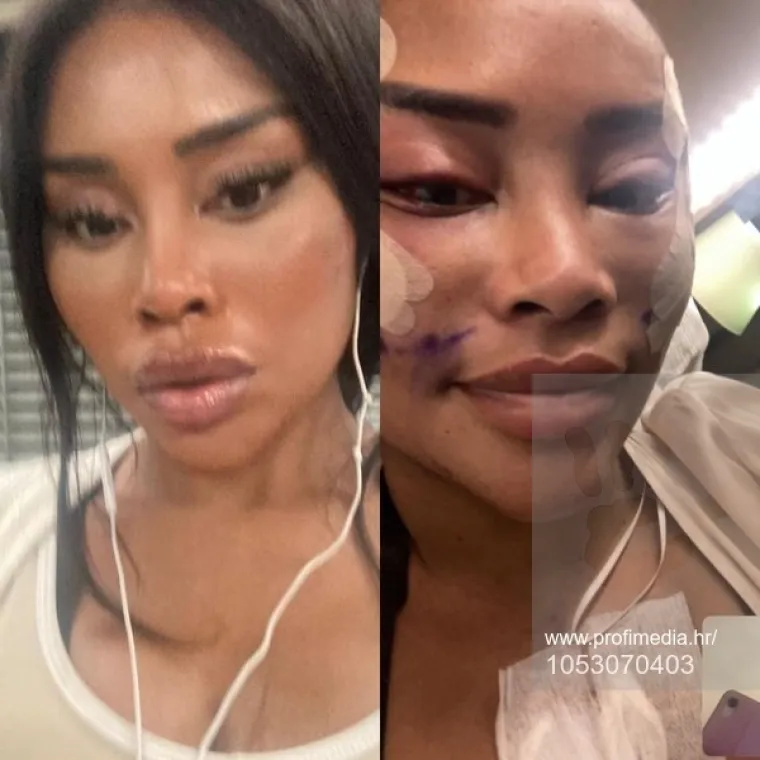 Od njezine transformacije padaju vilice: Potrošila masnu lovu, ovako izgleda danas