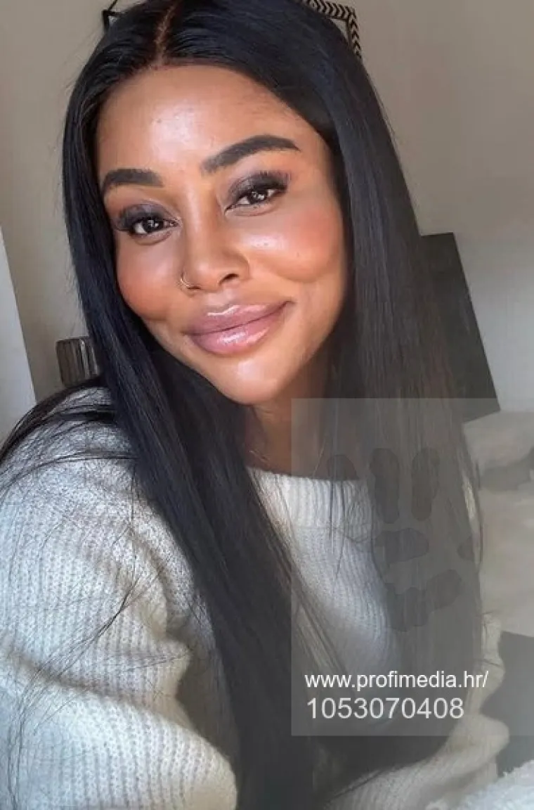 Od njezine transformacije padaju vilice: Potrošila masnu lovu, ovako izgleda danas