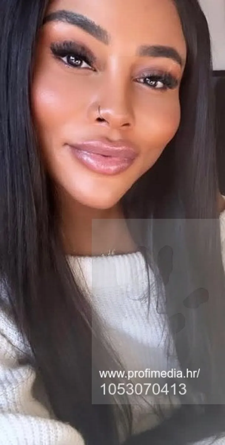 Od njezine transformacije padaju vilice: Potrošila masnu lovu, ovako izgleda danas