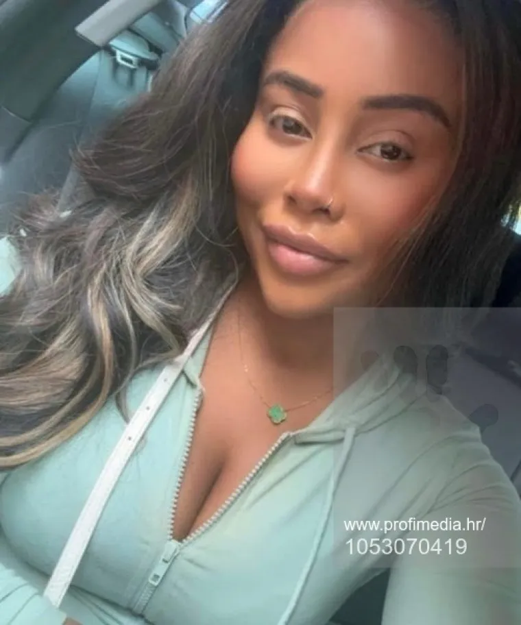 Od njezine transformacije padaju vilice: Potrošila masnu lovu, ovako izgleda danas