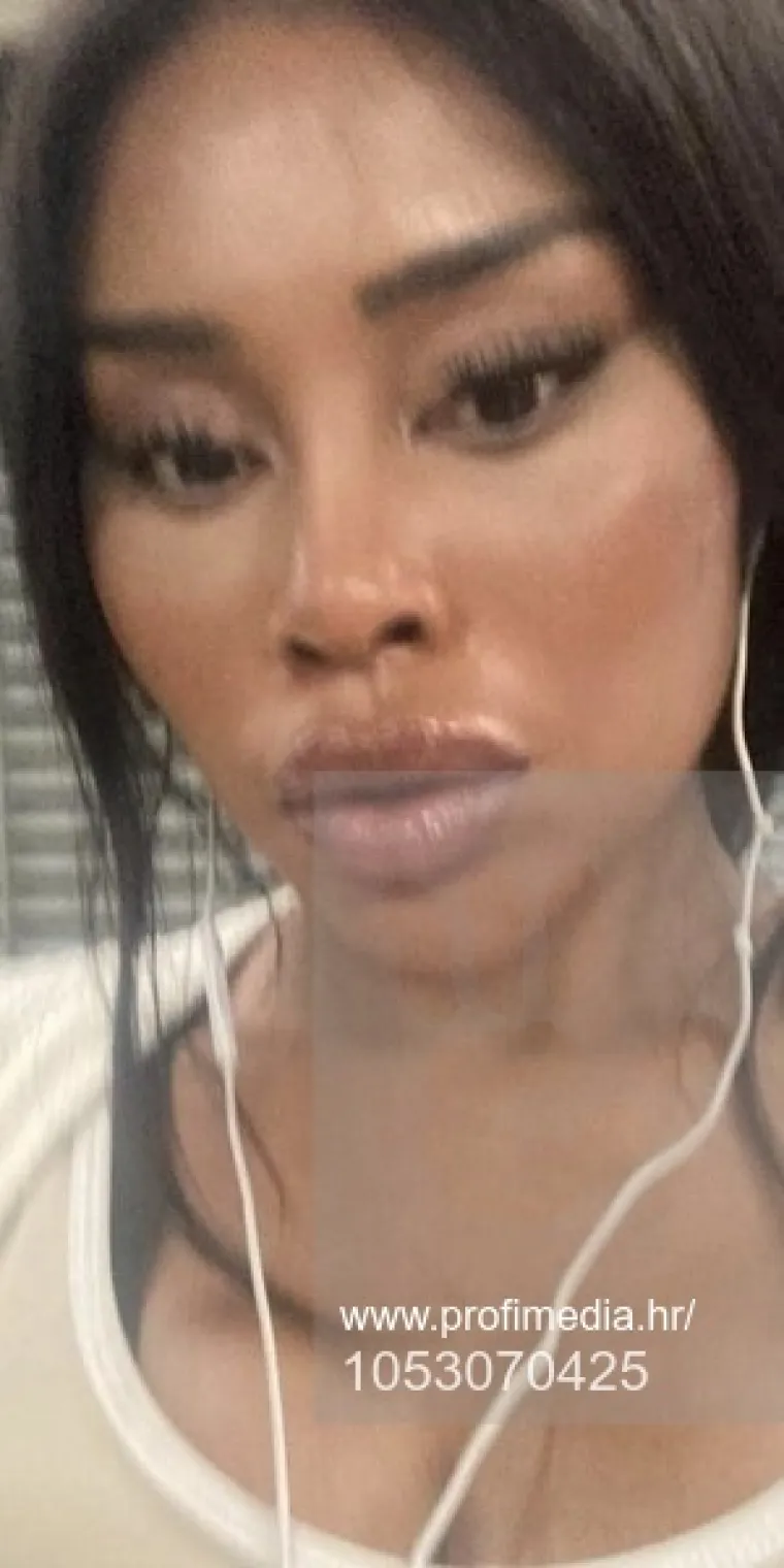 Od njezine transformacije padaju vilice: Potrošila masnu lovu, ovako izgleda danas