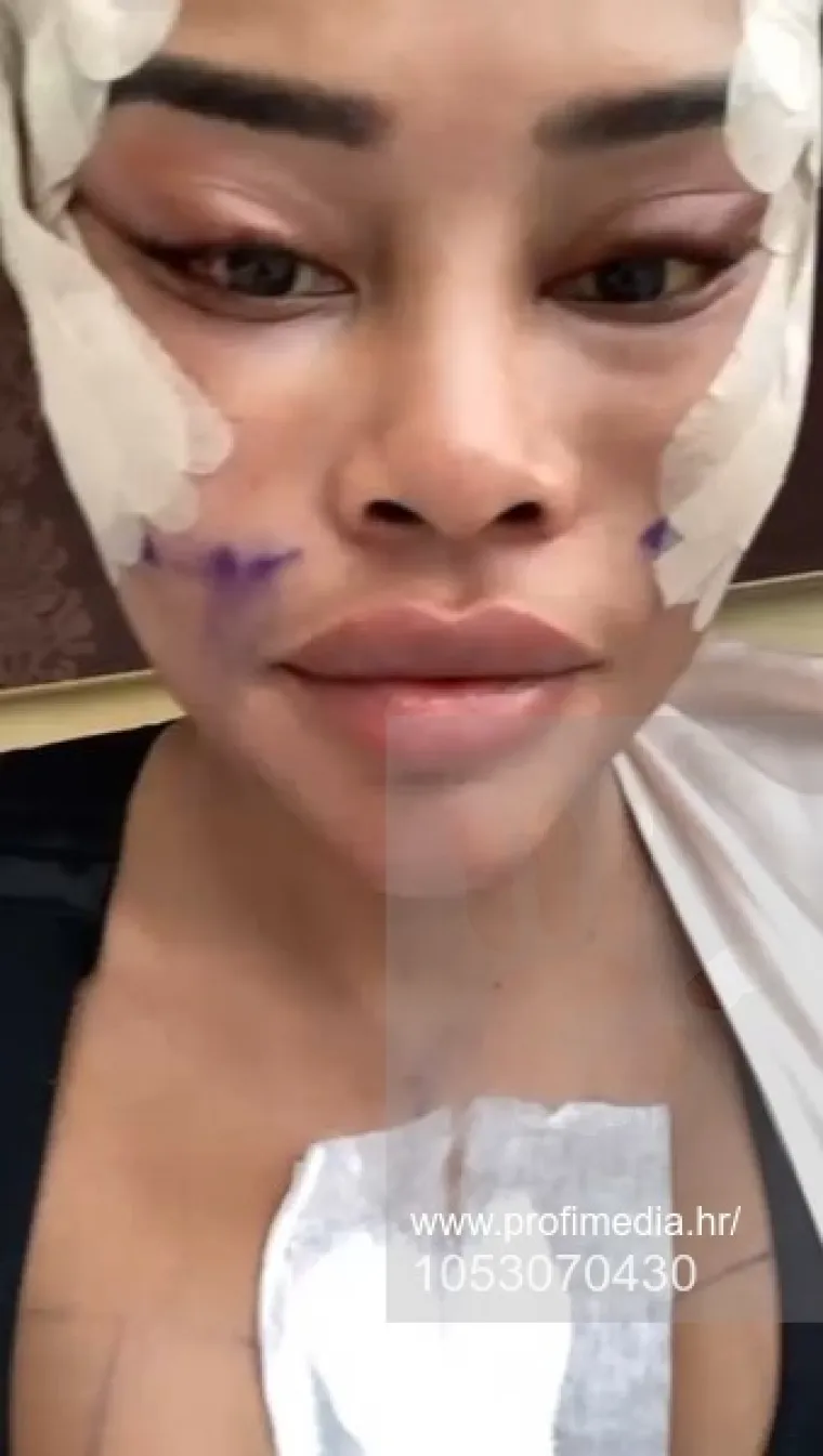 Od njezine transformacije padaju vilice: Potro&scaron;ila masnu lovu, ovako izgleda danas