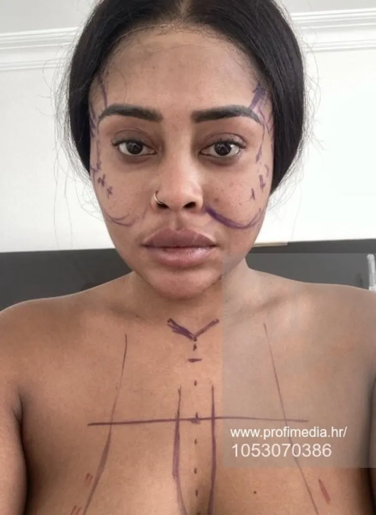 Od njezine transformacije padaju vilice: Potro&scaron;ila masnu lovu, ovako izgleda danas