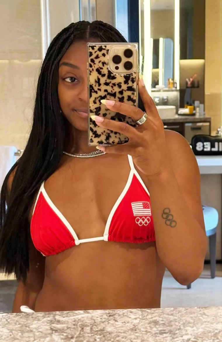 Najtrofejnija gimnastičarka govorila o operaciji grudi: 'Lagali ste, muž me nosio do kupaonice'