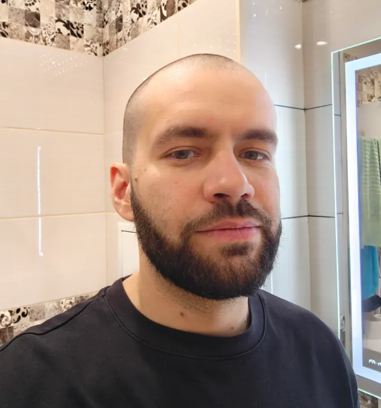 Probudili su se i napravili rez života: Nova frizura potpuno im je promjenila izgled