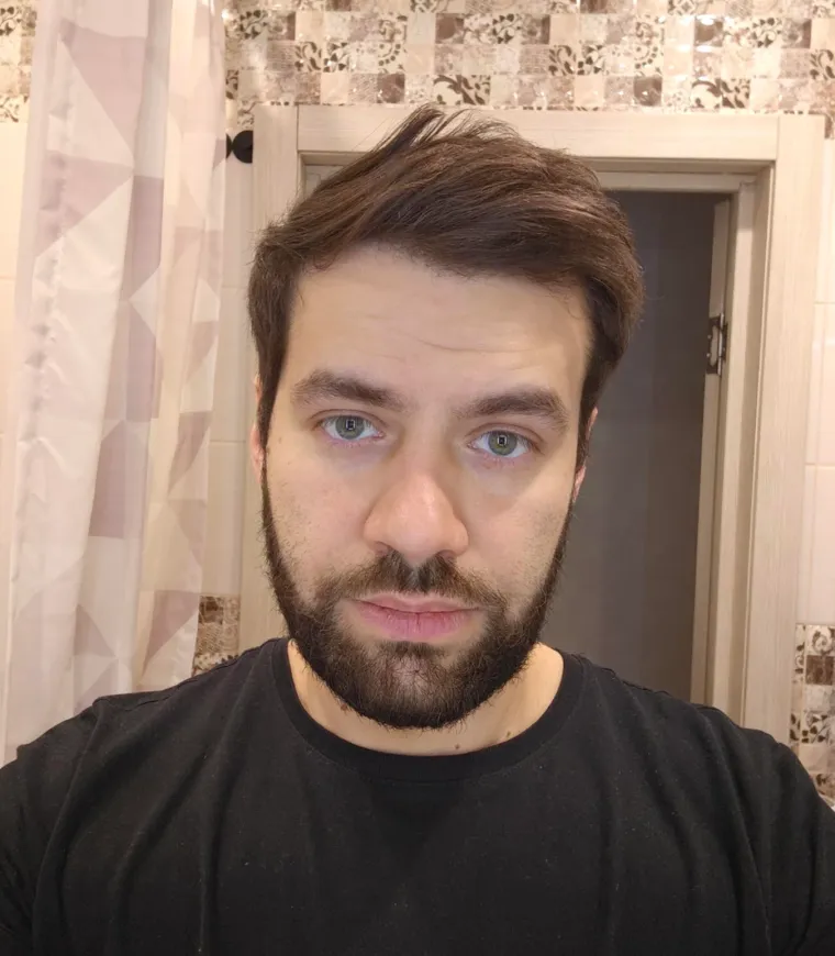 Probudili su se i napravili rez života: Nova frizura potpuno im je promjenila izgled