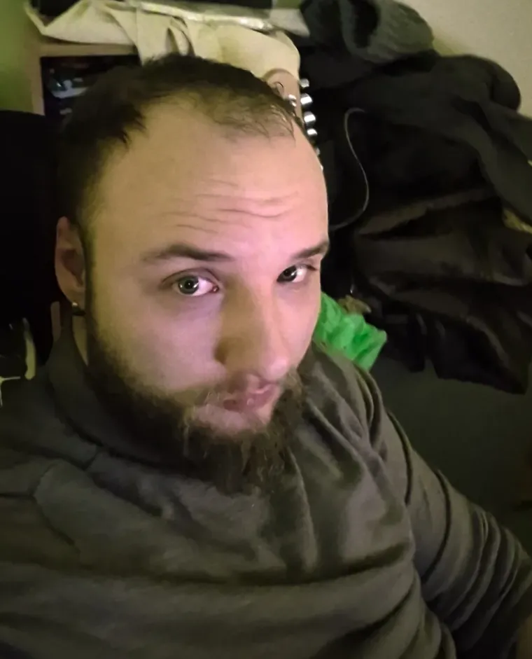 Probudili su se i napravili rez života: Nova frizura potpuno im je promjenila izgled