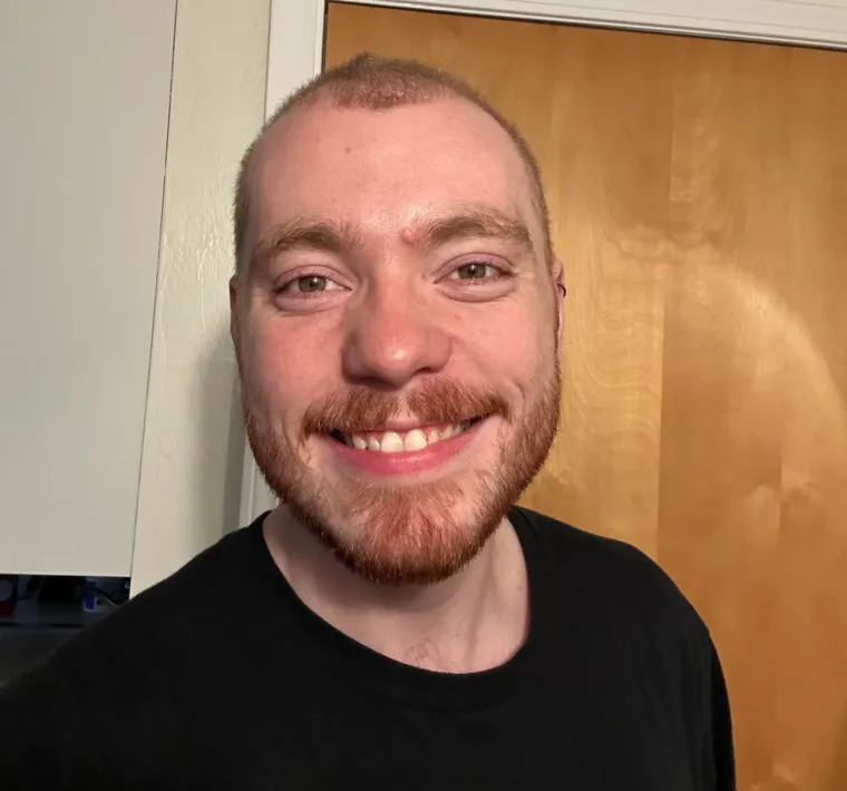 Probudili su se i napravili rez života: Nova frizura potpuno im je promjenila izgled