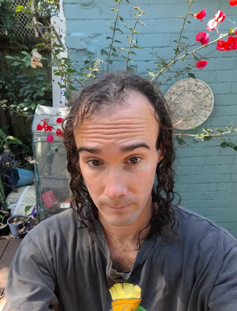 Probudili su se i napravili rez života: Nova frizura potpuno im je promjenila izgled