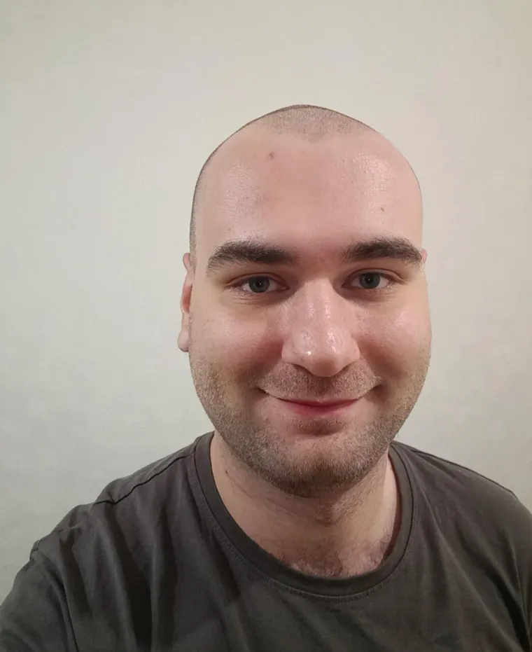 Probudili su se i napravili rez života: Nova frizura potpuno im je promjenila izgled