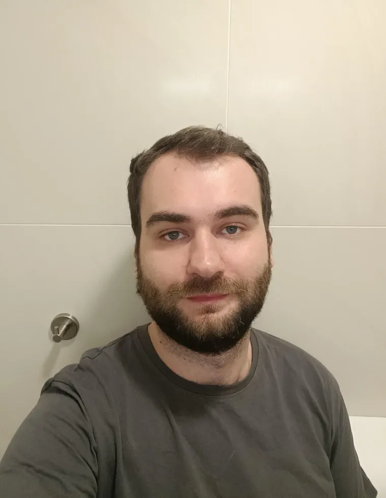 Probudili su se i napravili rez života: Nova frizura potpuno im je promjenila izgled