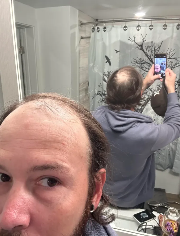 Probudili su se i napravili rez života: Nova frizura potpuno im je promjenila izgled