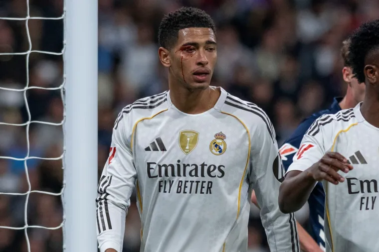 Prava tučnjava na Bernabeu! Realovac kao da je bio u ringu, Alonso poludio na svog igrača