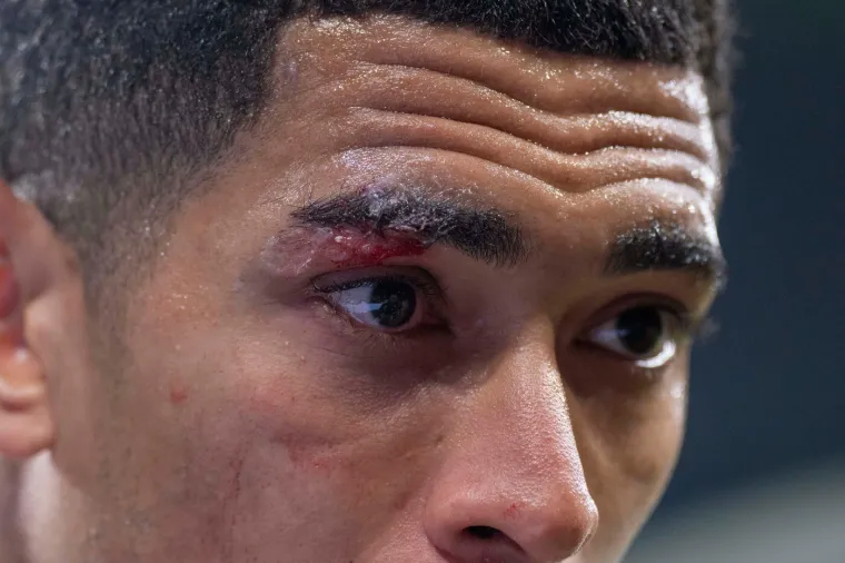 Prava tučnjava na Bernabeu! Realovac kao da je bio u ringu, Alonso poludio na svog igrača