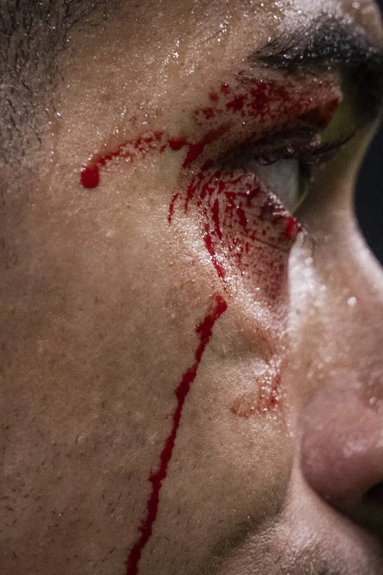 Prava tučnjava na Bernabeu! Realovac kao da je bio u ringu, Alonso poludio na svog igrača