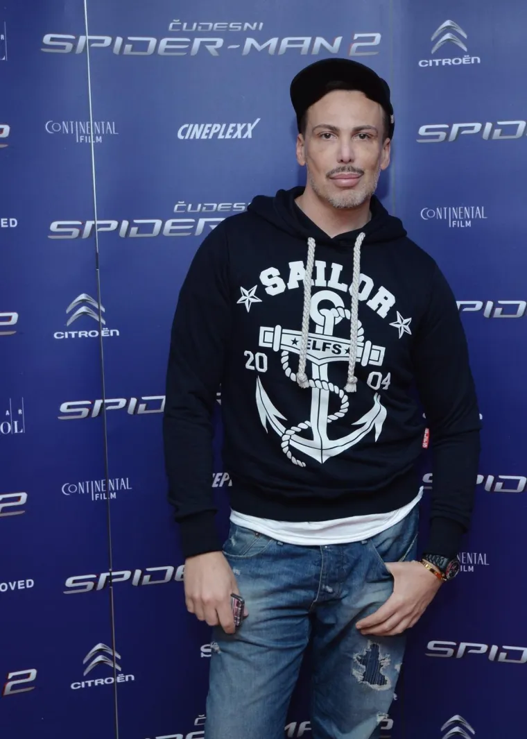 Pogledajte kako je Neven Ciganović izgledao prije estetskih zahvata, mnogi ga ne bi prepoznali