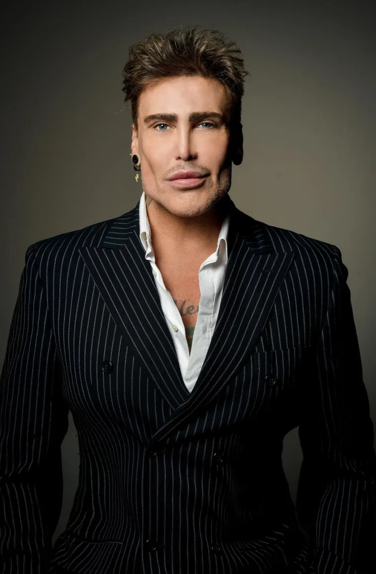 Pogledajte kako je Neven Ciganović izgledao prije estetskih zahvata, mnogi ga ne bi prepoznali