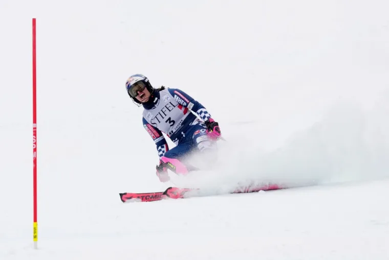 Jedna od najzgodnijih skija&scaron;ica iznenadila crnim predmetom na licu: Pogledajte o čemu se radi