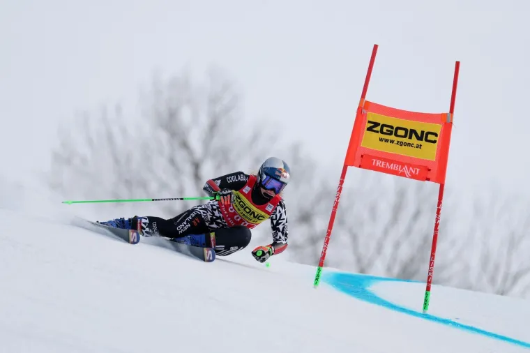 Jedna od najzgodnijih skija&scaron;ica iznenadila crnim predmetom na licu: Pogledajte o čemu se radi