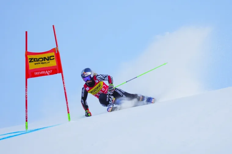 Jedna od najzgodnijih skija&scaron;ica iznenadila crnim predmetom na licu: Pogledajte o čemu se radi