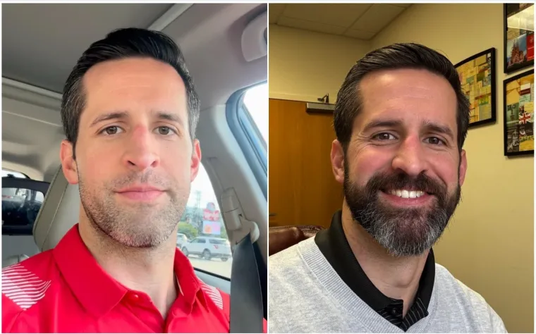 Jesu li brade mu&scaron;karcima &scaron;to i ženama &scaron;minka? Neki kada se obriju ne izgledaju kao iste osobe