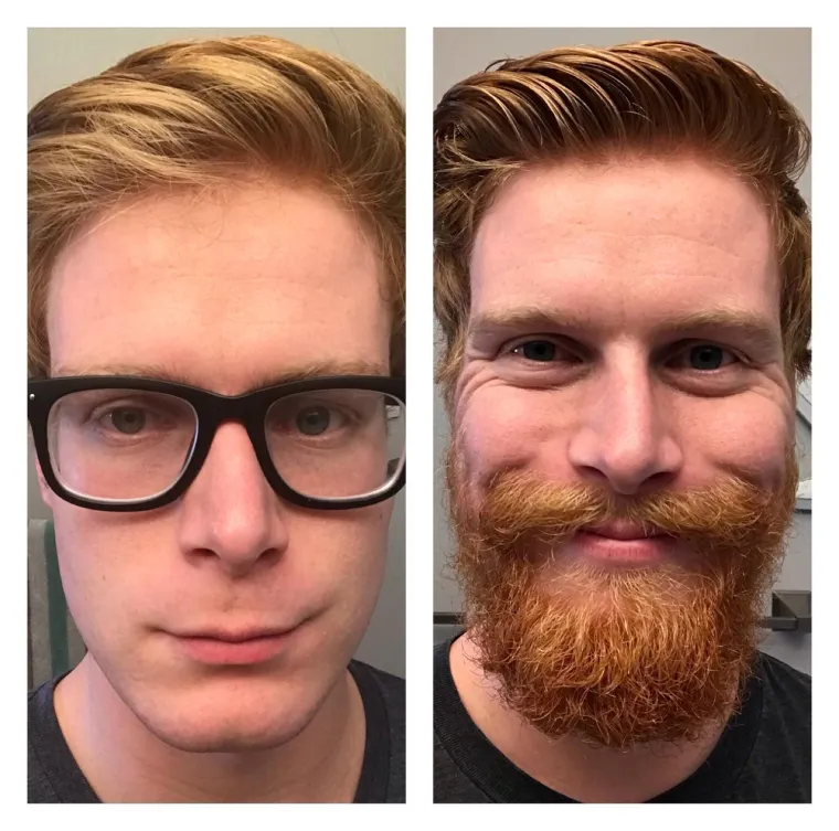 Jesu li brade mu&scaron;karcima &scaron;to i ženama &scaron;minka? Neki kada se obriju ne izgledaju kao iste osobe