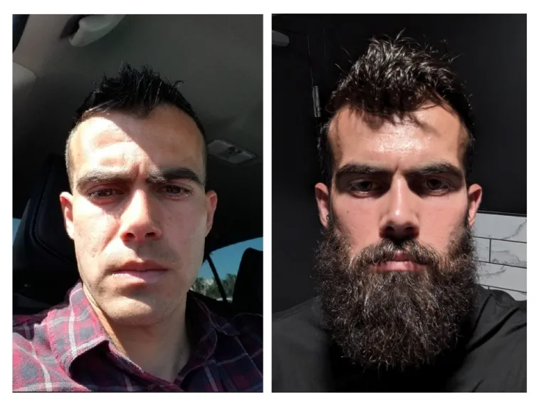 Jesu li brade mu&scaron;karcima &scaron;to i ženama &scaron;minka? Neki kada se obriju ne izgledaju kao iste osobe